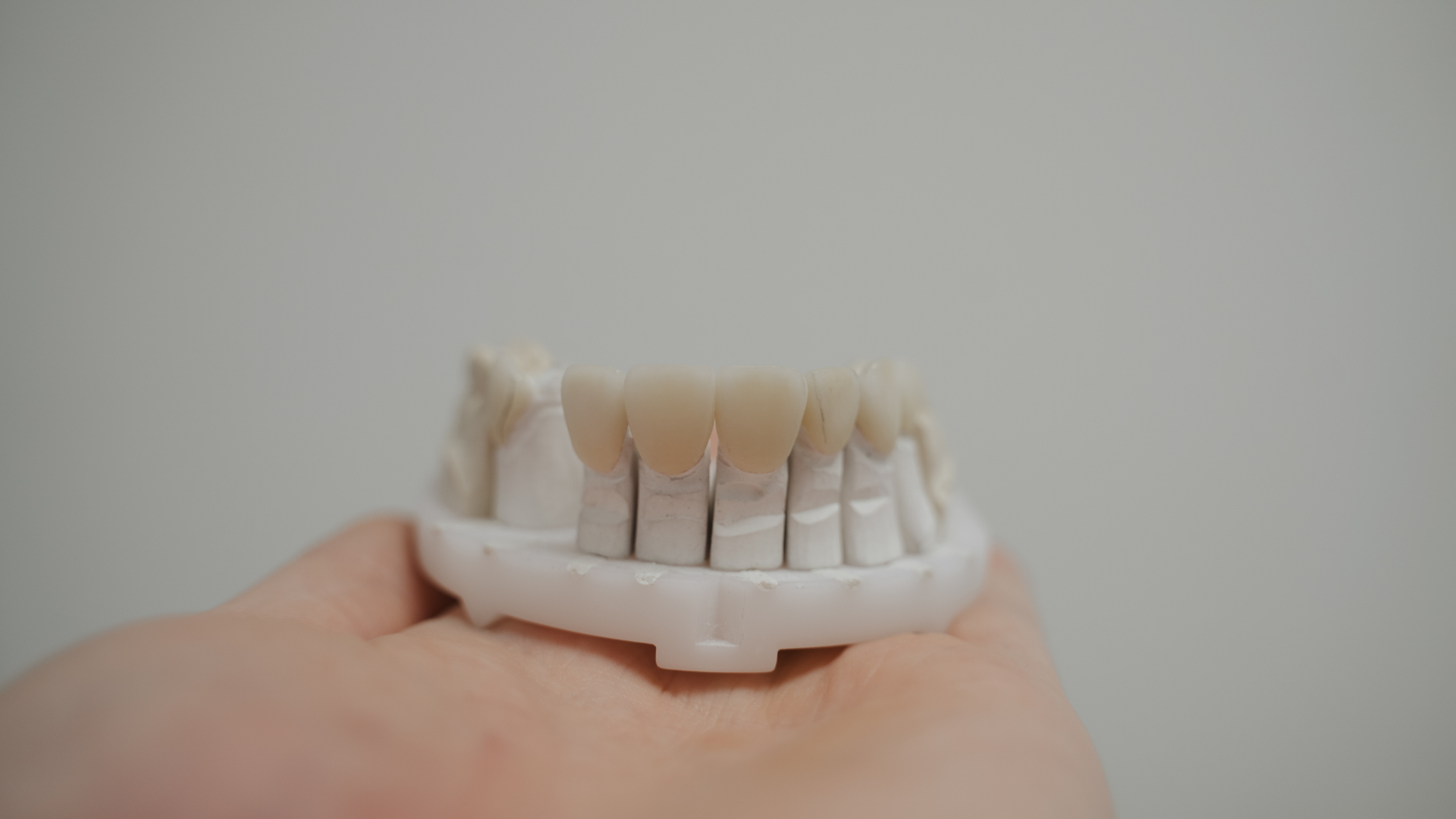 Fertiger Zahnersatz aus dem Denta1 Meisterlabor in der Hand