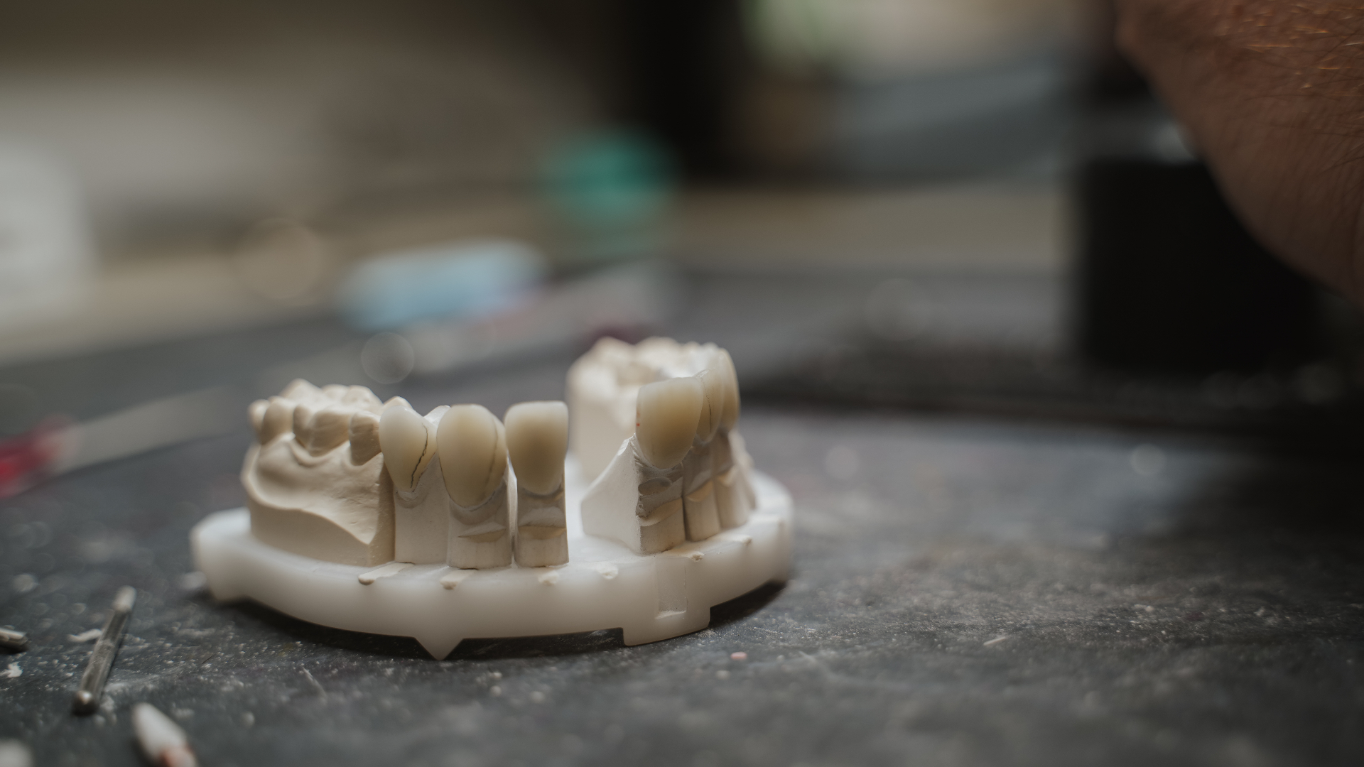 Zahnersatz-Modell im Denta1 Labor – gefräst und bereit zur Veredelung