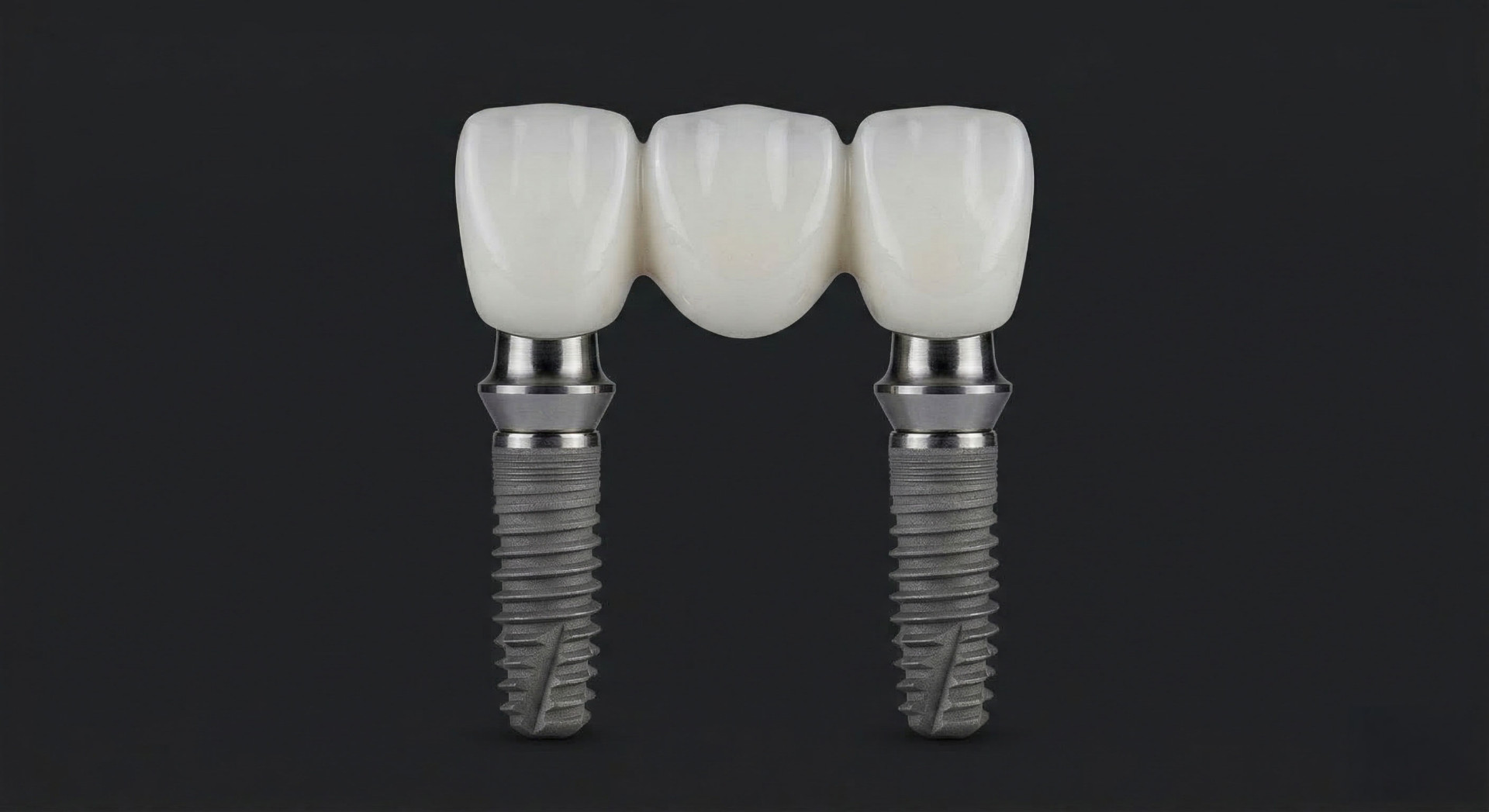 Implantatgetragene Brücke