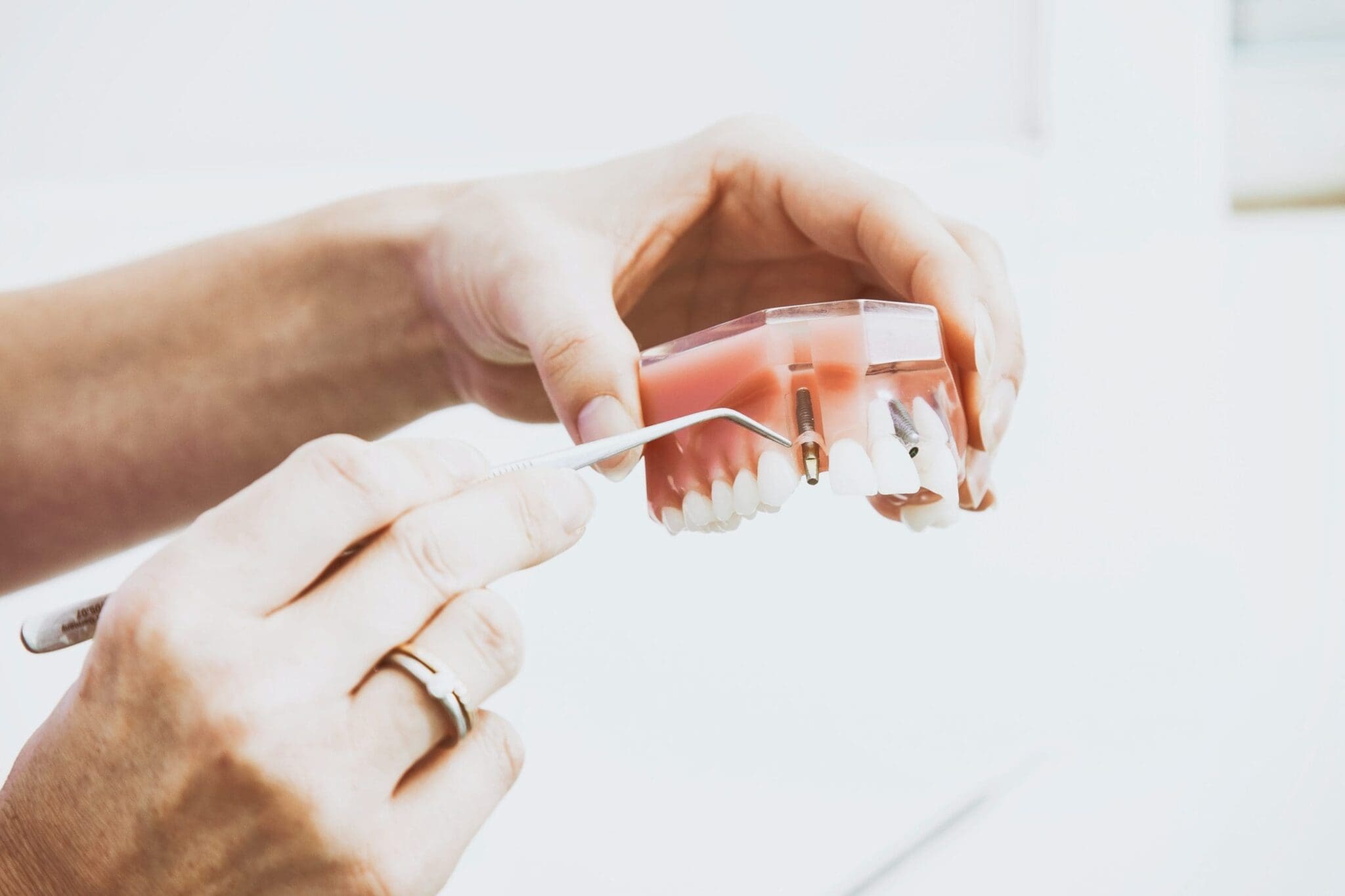 Keramikimplantate 1